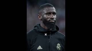 Germany Vs. Scotland Euro 2024