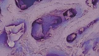 Structem Microworld Freeze Dried Blueberry Powder In A Sem