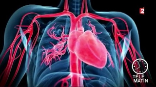 Santé - Crise cardiaque : les idées reçues