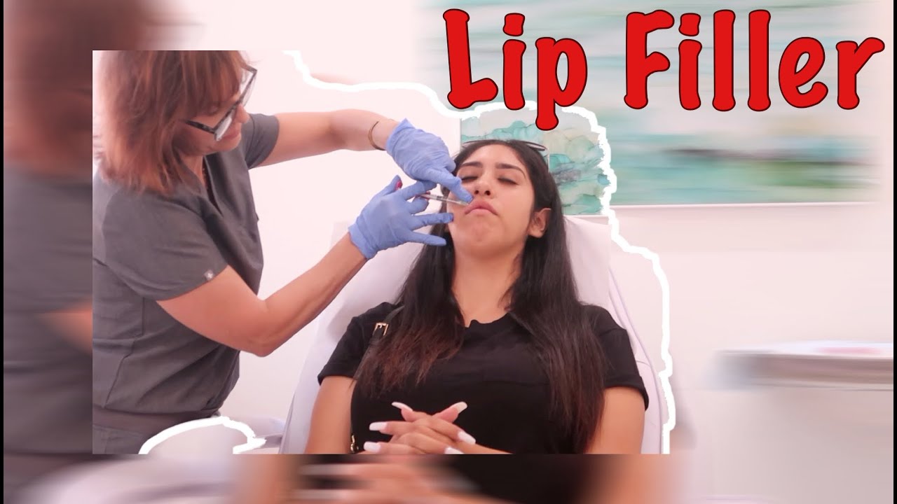 I GOT MY LIPS DONE/ MY LIP FILLER EXPERIENCE/ MAKEUP BY CLAUDIA 