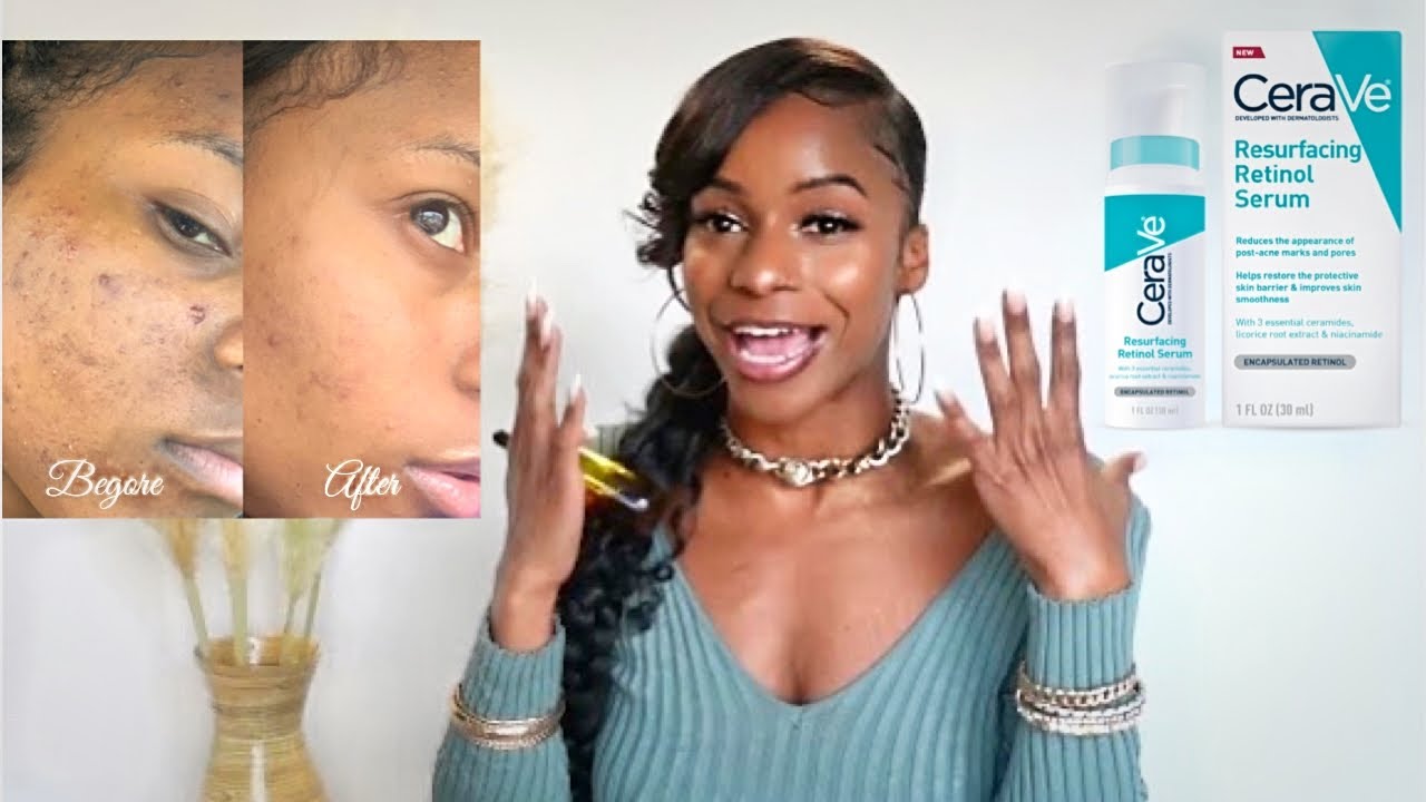 Updated skincare routine✨ CeraVe Resurfacing Retinol Serum 60day review|  How I got rid of acne scars - YouTube