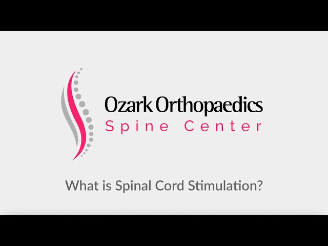 Spinal Cord Stimulation for Back Pain