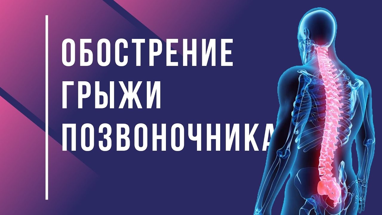 с днем хрустящего позвоночника. похрустывание позвоночника. межпозвоночная грыжа грудного отдела. стеноз позвоночного канала поясничного отдела. спинальный стеноз поясничного отдела позвоночника.