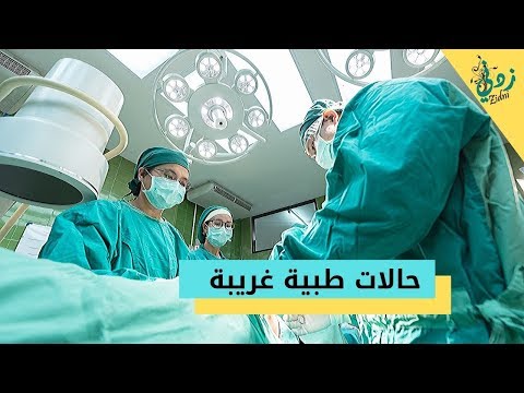 حالات طبية غريبة !! || قناة زدني