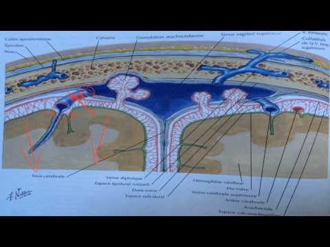 Vidéo: Hématome - Causes Et Symptômes Des Hématomes Traumatiques Et Intracrâniens