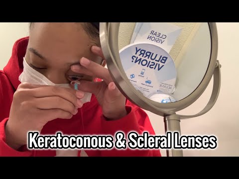 I CAN FINALLY SEE | SCLERAL LENSES