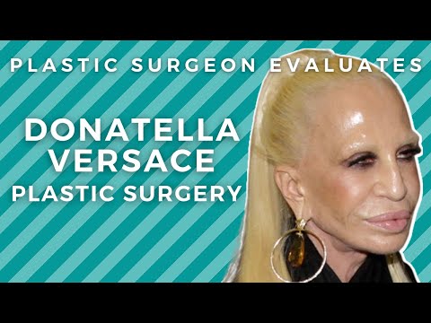 Donatella Versace's Plastic Surgery — Experts Weight In – Hollywood Life