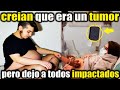 todos creían que este HOMBRE tenia un ENORME TUMOR, pero lo que tuvo dejo a todos IMPACTADOS.