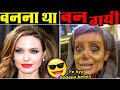 7 लोग जिन्हें PLASTIC SURGERY हज़म नहीं हुयी 7 People Who Took Plastic Surgery To Next Level