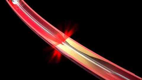 Optical Coherence Tomography Animation