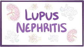 Lupus nephritis - causes, symptoms, diagnosis, treatment, pathology