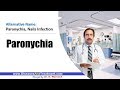 Paronychia : Causes, Diagnosis, Symptoms, Treatment, Prognosis