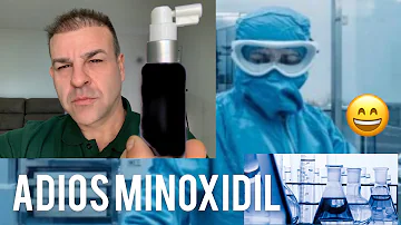 ¿Necesito utilizar minoxidil después de un trasplante capilar?