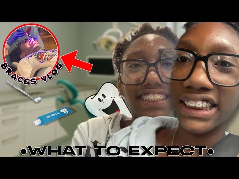 I GOT BRACES 🦷 | My Experience!!! | Aianna Smith