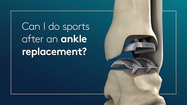 Can I do sports after an ankle replacement?