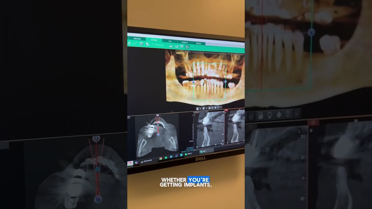 🦷 2D vs. 3D: The Future of Dental Imaging! 🔍✨