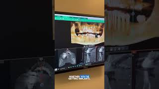🦷 2D vs. 3D: The Future of Dental Imaging! 🔍✨