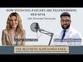 Stem Cell Patches 🔥 How Med Spas Are Healing Faster &amp; Growing Revenue