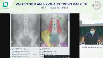 Đọc phim X quang bụng - BS Nguyễn Quang Trọng