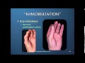 Thumb CMC Osteoarthritis: Surgical & Post Surgical Insights Preview