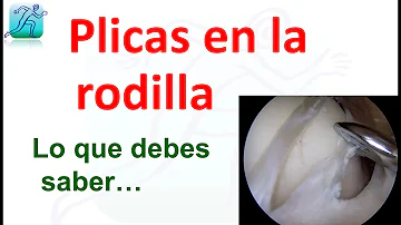 ¿Cómo se cura el pinzamiento de rodilla?