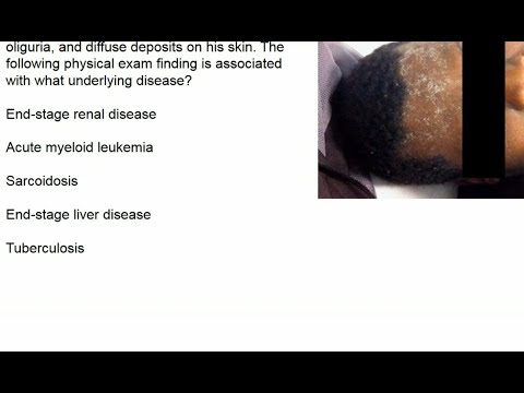 Lister Cs Workshop Manual Pdf