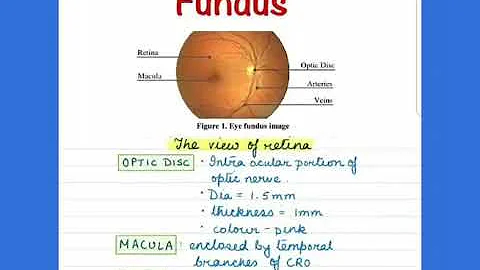 A visual guide for fundus imaging #neetpg #inicet #study #mbbs #ophthalmology
