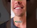Benefits of brushing teeth with charcoal