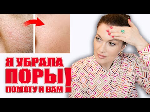 Убрала расширенные поры! Помогу и вам! Работающие решения💥, никакой "воды"💦!