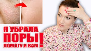 Убрала расширенные поры! Помогу и вам! Работающие решения💥, никакой 