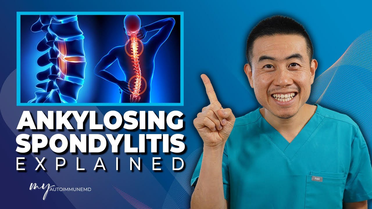 Have Chronic Back Pain You Might Have Ankylosing Spondylitis have-chronic-back-pain-you-might-have-ankylosing-spondylitis