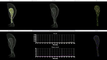 Inositol 1,4,5-Trisphosphate Receptor (IP3R) Model in a Dendritic Spine