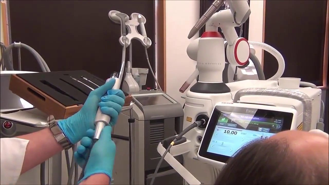 Laser Skin Treatment Montreal Fotona 3D Rejuvenation YouTube