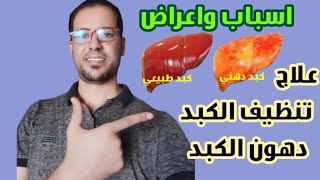 كيف تنظف الكبد وتجدد خلاياه | علاج دهون الكبد والكولسترول والدهون الثلاثية