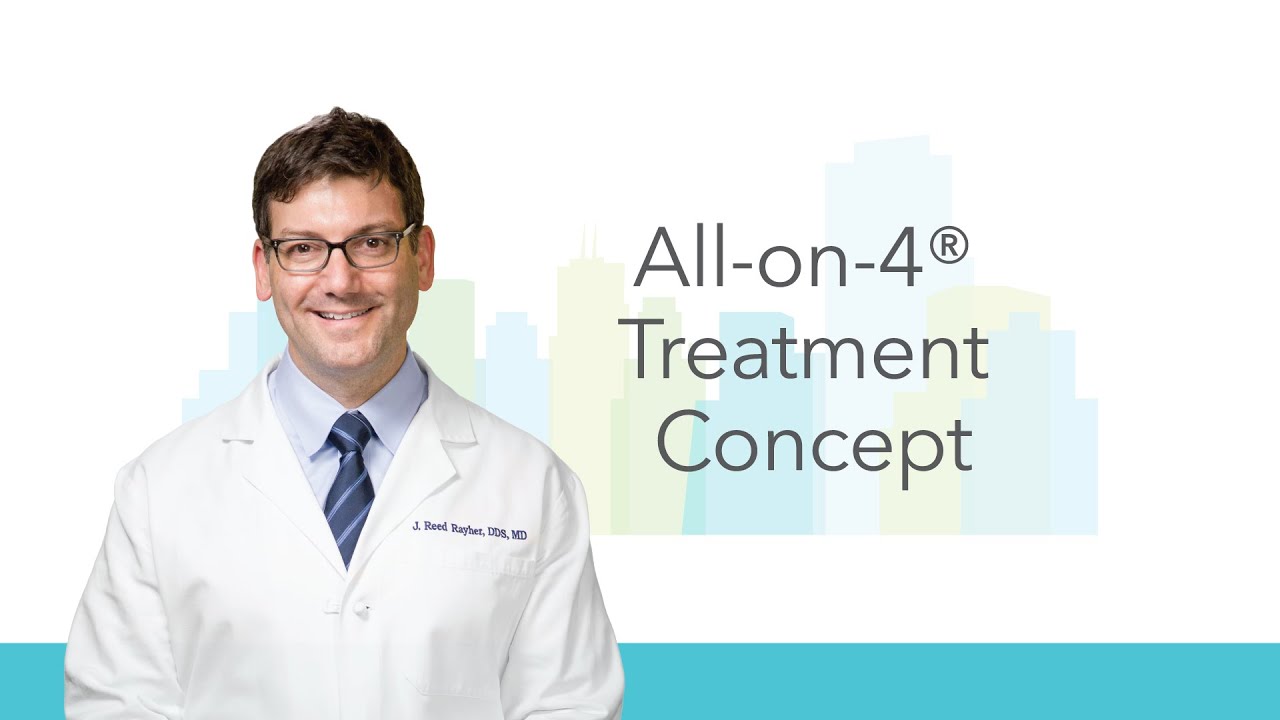 All-on-4® Treatment Concept Information in San Francisco CA | Union Square Oral Surgery
