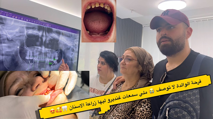 لوليدة حيدو ليها الاسنان🦷 😳غدي نديروليها زراعة الاسنان 🤭