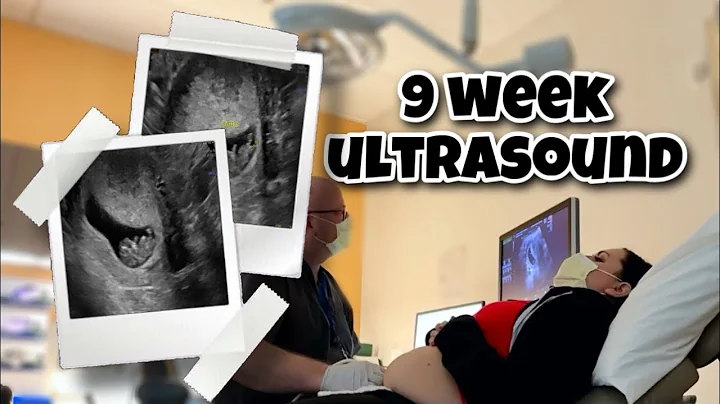 9 Week Pregnancy Ultrasound | Vlog 246