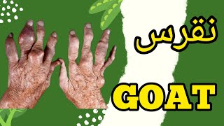 نقرس:بیماری نقرس را بشناسید😱 #نقرس #GOUT