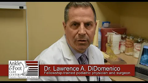 Dr. DiDomenico Discusses Advantages of Ankle Repla...