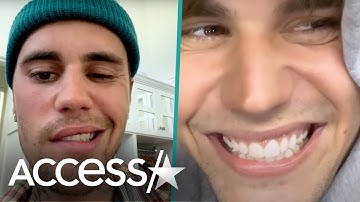 Justin Bieber Shares Facial Mobility Update After Suffering Partial Facial Paralysis