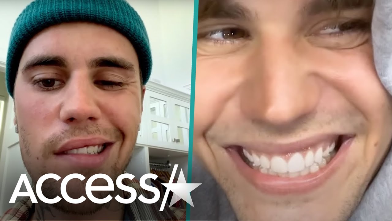 Justin Bieber Shares Look At Facial Mobility Months After Suffering Partial Facial Paralysis
