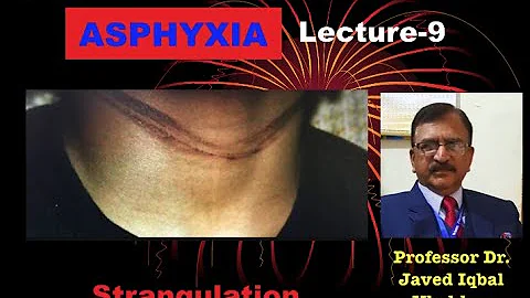 9. ASPHYXIA STRANGULATION LIGATURE STRANGULATION SYMPTOMS OCCURRENCE MODE OF DEATH AUTOPSY FINDINGS