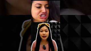 Pria bibir sumbing yang di bully #shorts