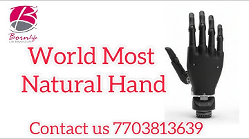 World Most Advanced I -Limb Bionic Hand  and its Features|| Bornlife Artificial Limbs Center