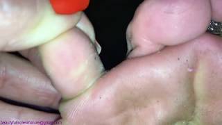 Dirty feet