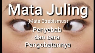 Mata Juling - Penyebab Dan Cara Menyembuhkan Nya