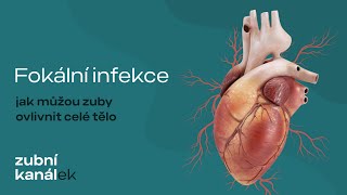 Fokální infekce - jak můžou zuby ovlivnit celé tělo