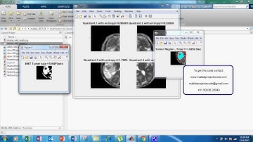Brain Tumor Detection Quantification MRI DCIOM IMAGES