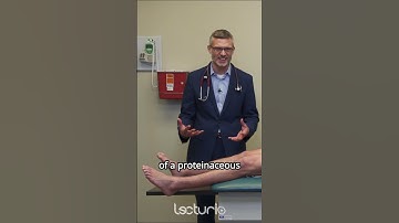 Assess edema like a pro! 💧  #nclexrn #lecturio