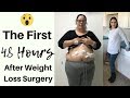 FIRST 48 HOURS AFTER VSG ● WHAT HAPPENED? ● GASTRIC SLEEVE SURGERY